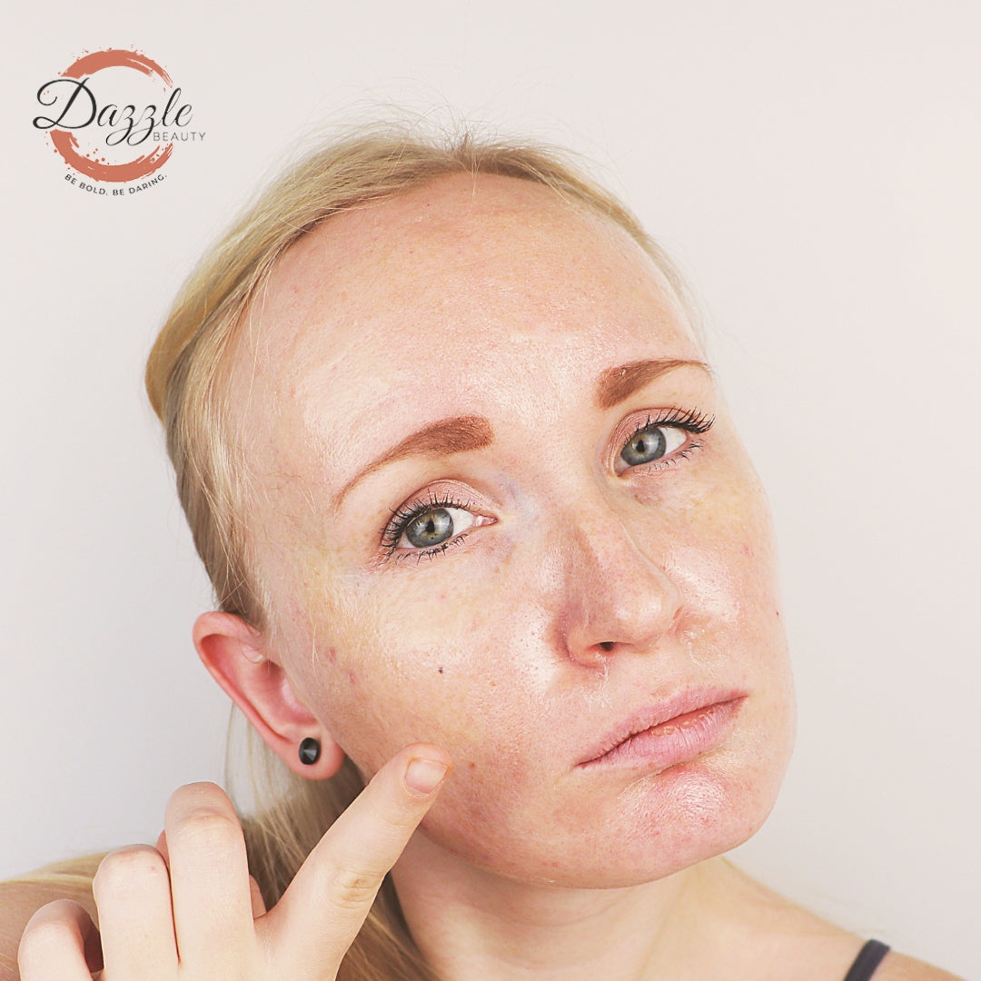 Understanding Oily Skin: Causes and Solutions !!