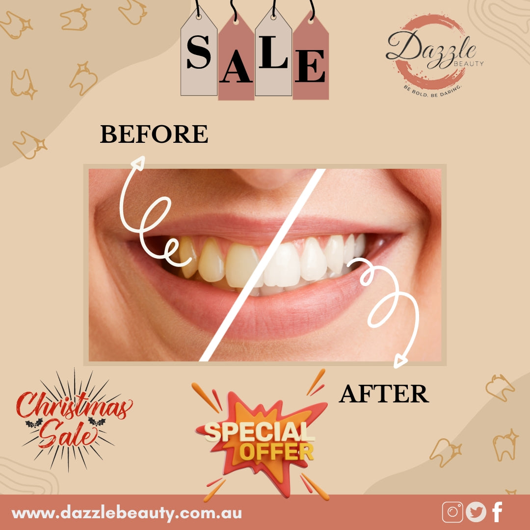 The Best Whitening Products for a Brighter Smile !!