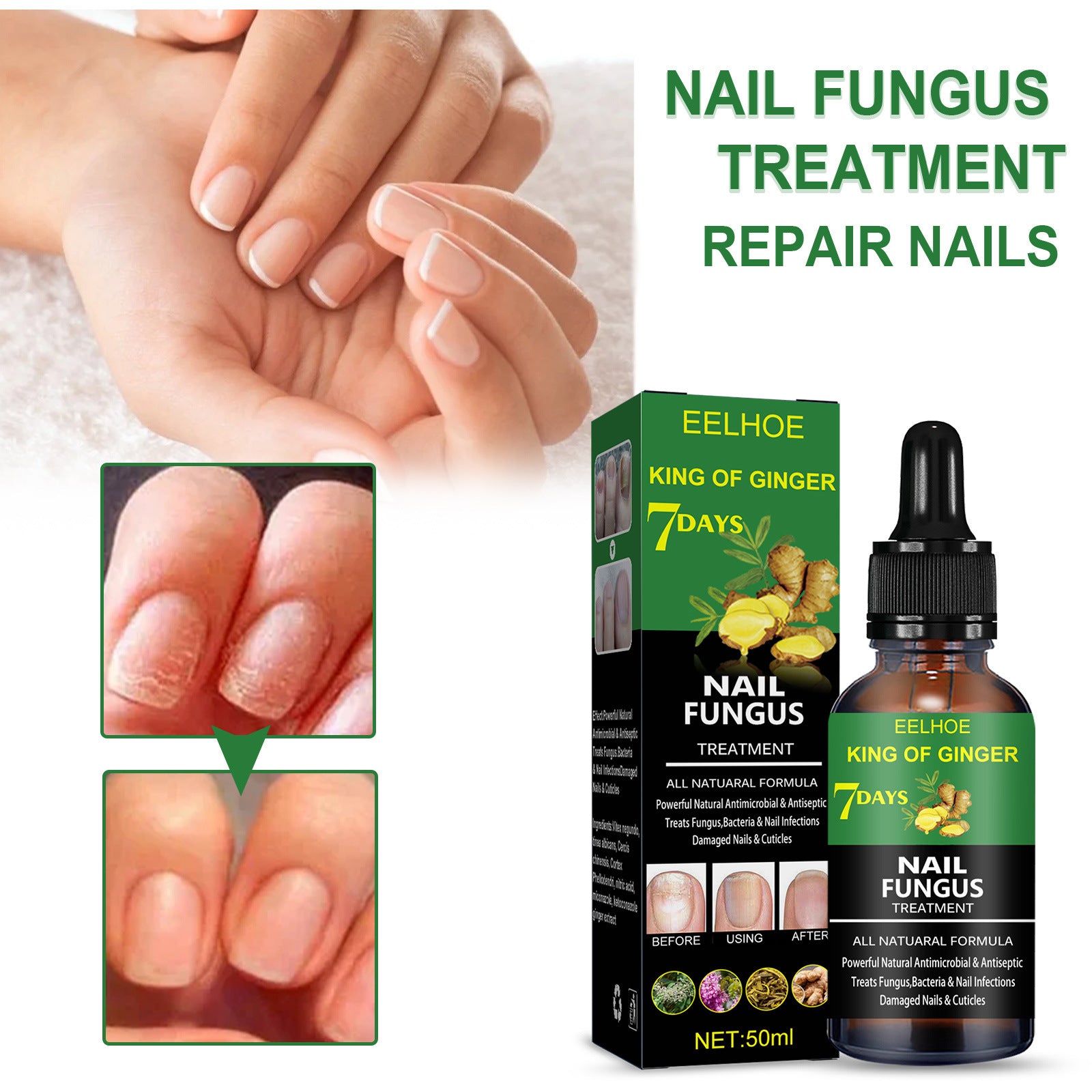 Nail Repair Solution( Hand Foot And Nail Care Solution)